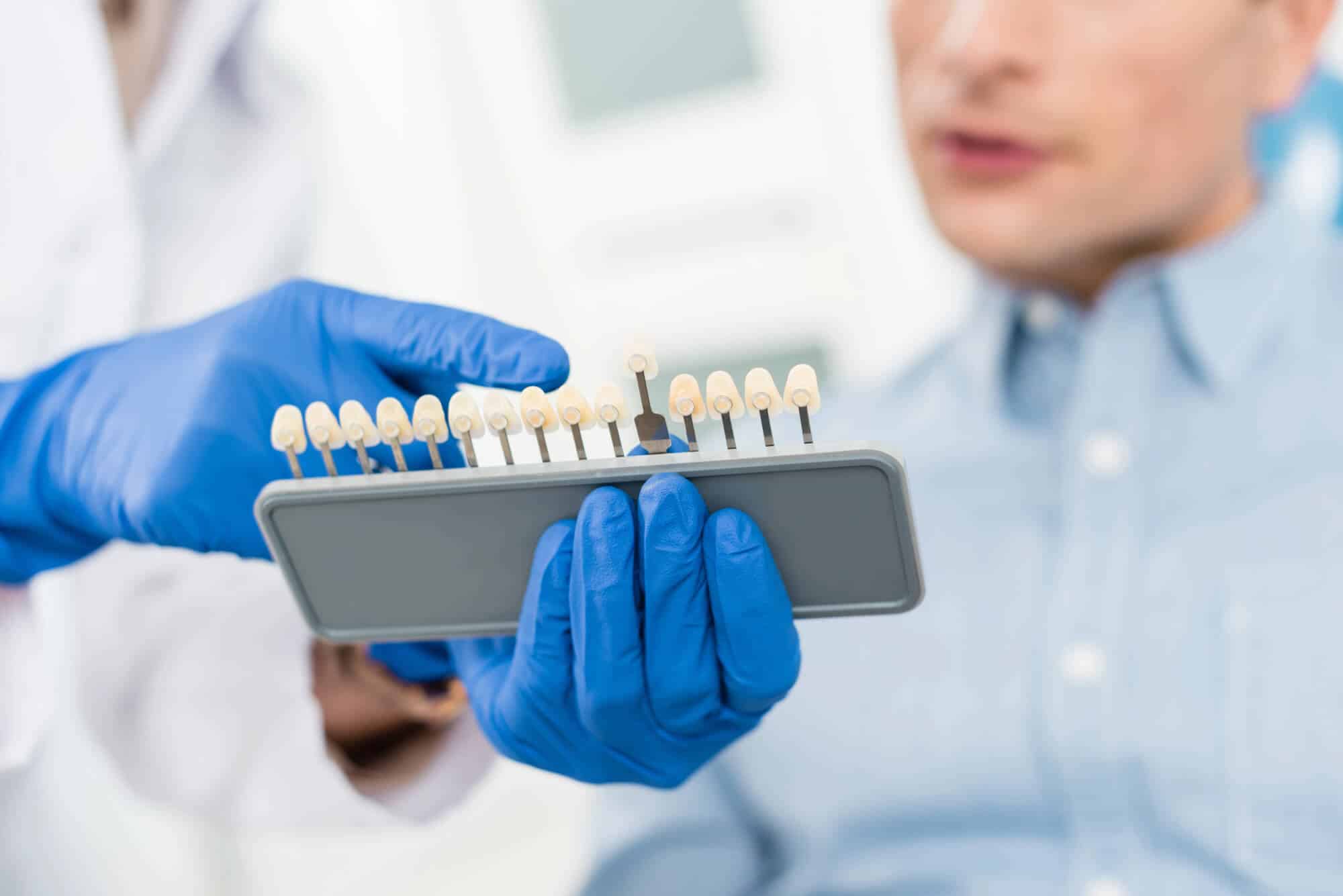 Dentist choosing a tooth shade for a dental implant restoration