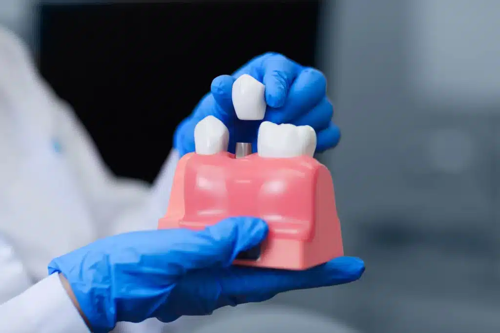 A Comparision of Zirconia and Titanium Implants from a Biological Holistic Dentistry Viewpoint